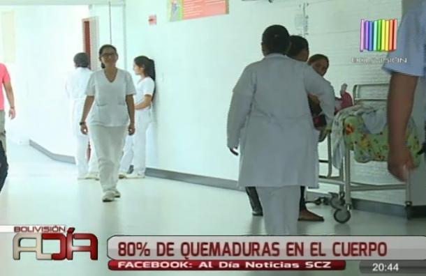 80% de quemaduras en el cuerpo – eju.tv