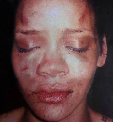 Imagen de Rihanna tras la golpiza que le propició Chris Brown.