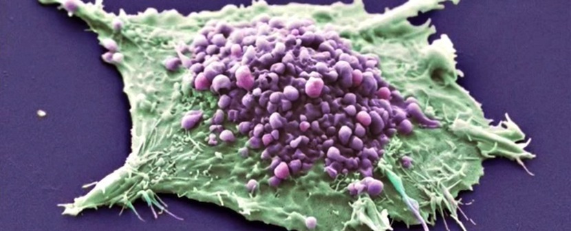 cáncer