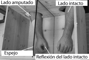 120105213730__57060766_mirror_therapy