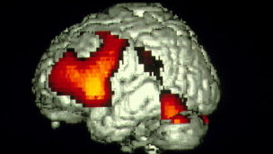 120201125708_lenguaje_cerebro_304x171_spl_nocredit