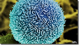 pancreatic_cancer_cells