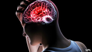 Cerebro