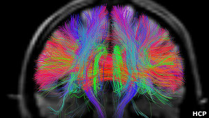 Con este proyecto los científicos esperan comprender cómo funciona la mente humana.