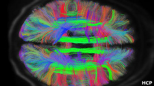 El diagrama del cableado del cerebro no es fijo.