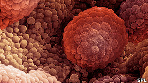 Actualmente el tratamiento de cáncer de próstata consiste en inyecciones de estrógeno.