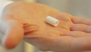 Crear implantes con impresora 3D