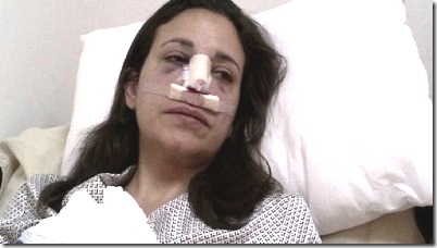 maria-corina-golpeada