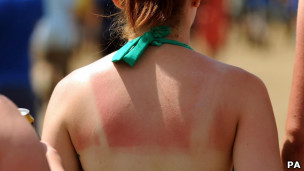 El exceso de sol tampoco es bueno, dicen los investigadores.