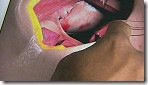 130606150930_surgery_app_144x81_other_nocredit