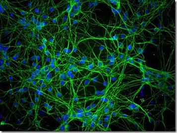 Neurons-Brain-800x600