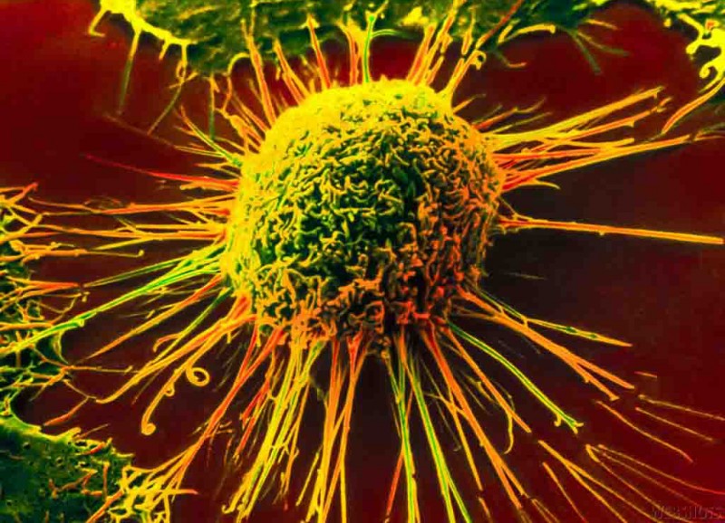 Varonbondumb (Flickr)