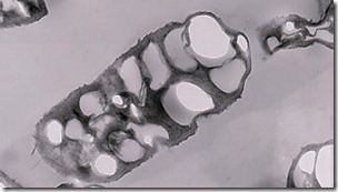 La bacteria es capaz de producir grandes cantidades de polímeros cuando se la somete a gran estrés. La bacteria es capaz de producir grandes cantidades de polímeros cuando se la somete a gran estrés.
