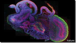 La estructura del tamaño de un guisante alcanzó el mismo nivel de desarrollo del cerebro de un feto de nueve semanas.