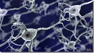 Los investigadores buscaron pequeñas protuberancias de células cerebrales llamadas espinas dendríticas.