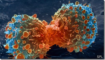 Los investigadores realizaron el estudio en un tipo de cáncer de pulmón.