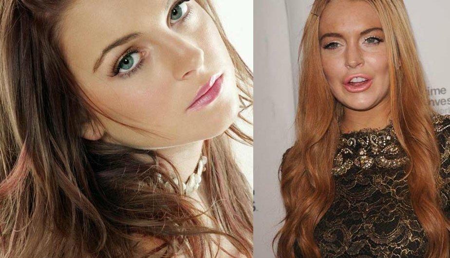 Las famosas son el mejor ejemplo de lo terrible que es abusar del botox (FOTOS)