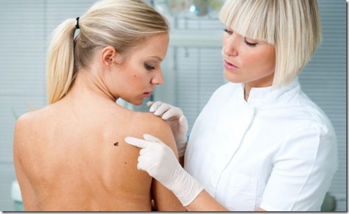 consejos-para-prevenir-un-melanoma-en-la-piel-3