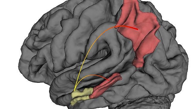 cerebro-alzheimer--644x362