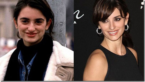 Penelope_Cruz-cirugia