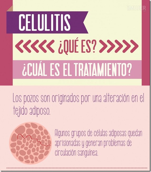 infografia-celulitis-1