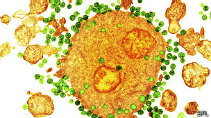 Virus VIH
