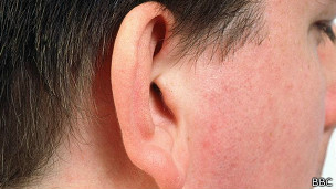 La idea es que la oreja creada en laboratorio crezca con el paciente.