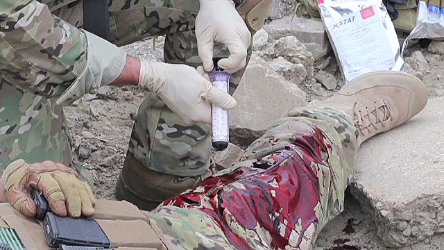 Diseñan herramienta que puede cerrar heridas de disparo en segundos Diseñan herramienta que puede cerrar heridas de disparo en segundos