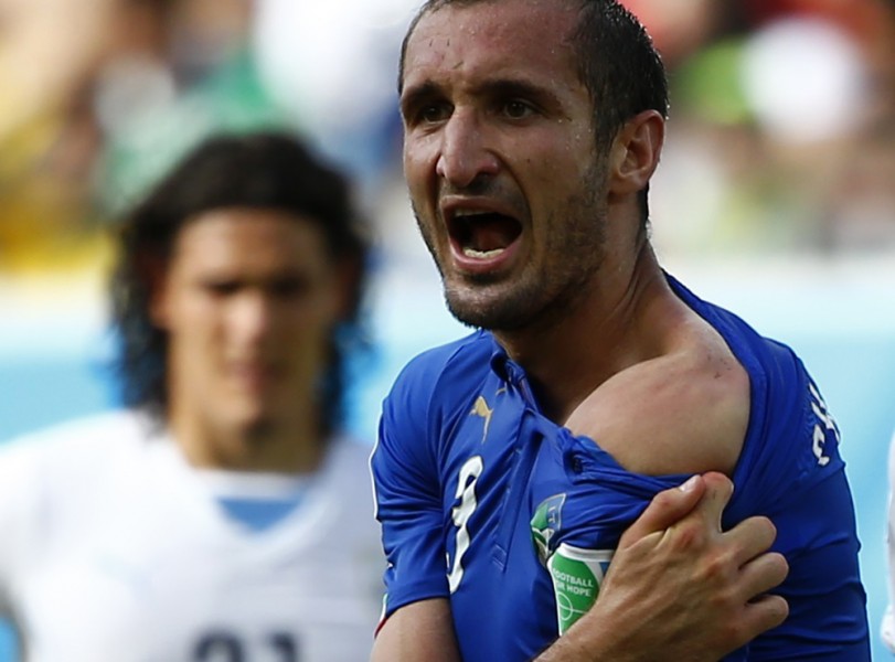 El seleccionado italiano Giorgio Chiellini muestra su hombro, diciendo que fue mordido por el delantero de Uruguay Luis Suárez durante su partido del Mundial del fútbol disputado en Natal, Brasil, 24 de junio del 2014.