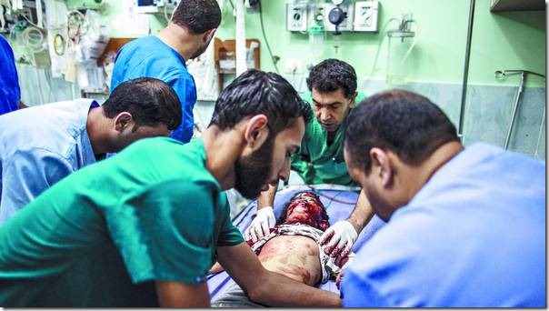 Herido-artilleria-Kamla-Adwan-GazaAFP_CLAIMA20140723_0031_27 (1)