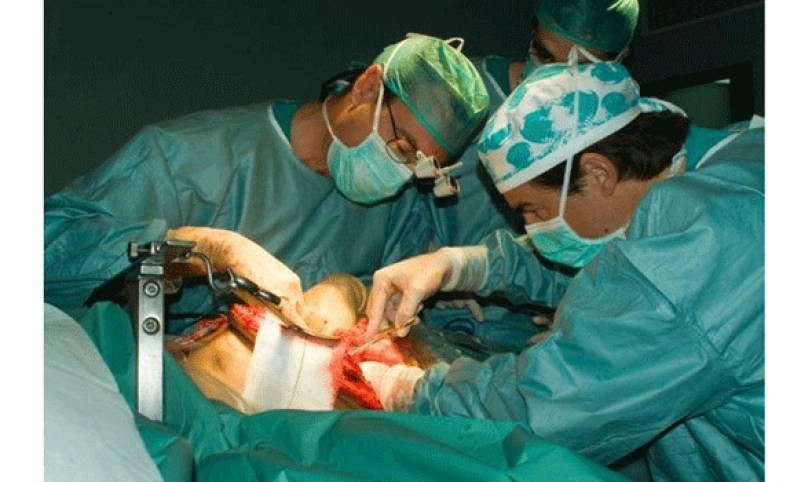 El cáncer de hígado ataca en un mayor porcentaje a las personas con cirrosis con un 80% en estas personas y solo un 20% en hígado sano.