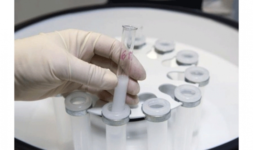 El 20% de la población en Bolivia demanda la reproducción asistida para poder tener hijos, aunque no todas acceden al tratamiento por el elevado costo.