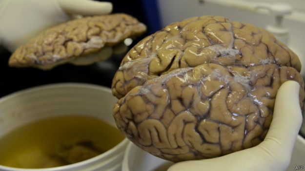Cerebro preservado en laboratorio