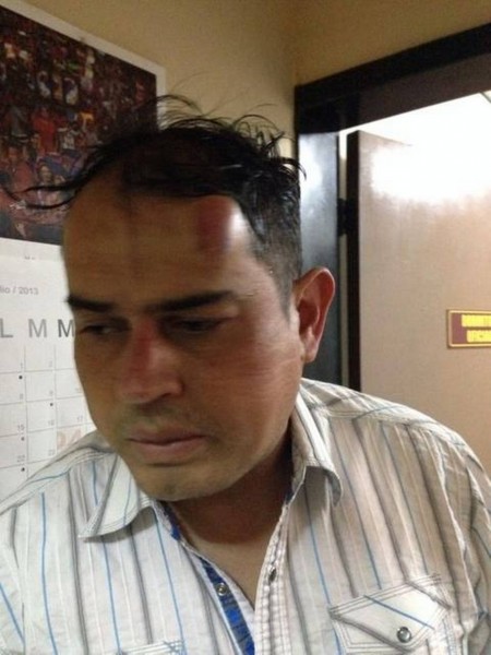 El capitán retirado Juan Carlos Nieto en una fotografía después de haber sido golpeado por agentes de la contrainteligencia militar.