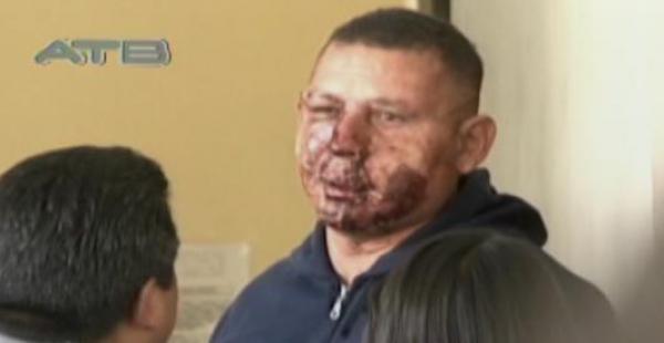 Franklin "Matador" Mamani fue el uniformado que detuvo al conductor en estado de ebriedad.