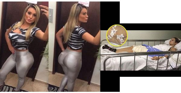 Miss BumBum: "Estoy siendo castigada por mi estúpida vanidad"