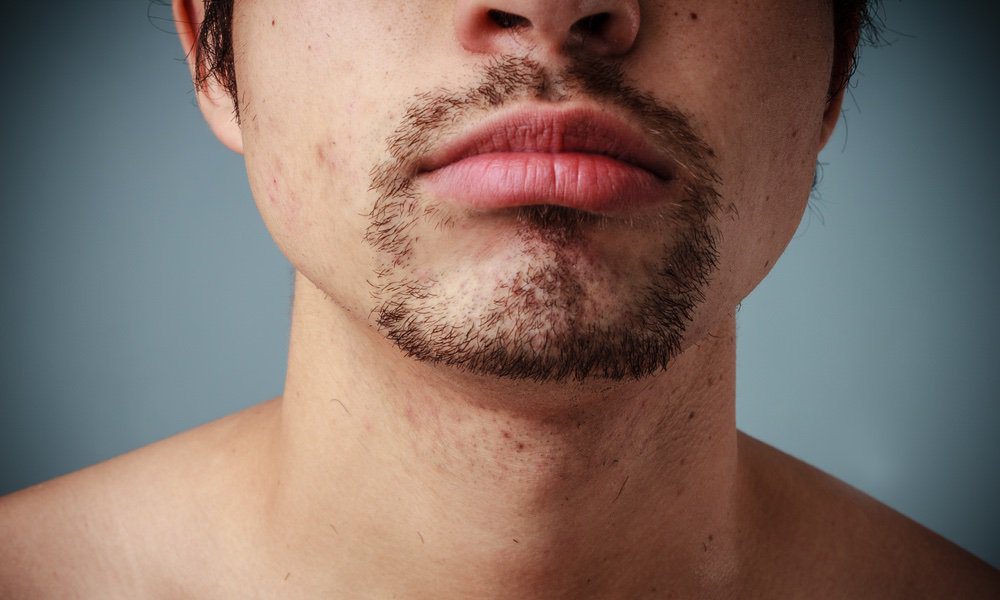 labios