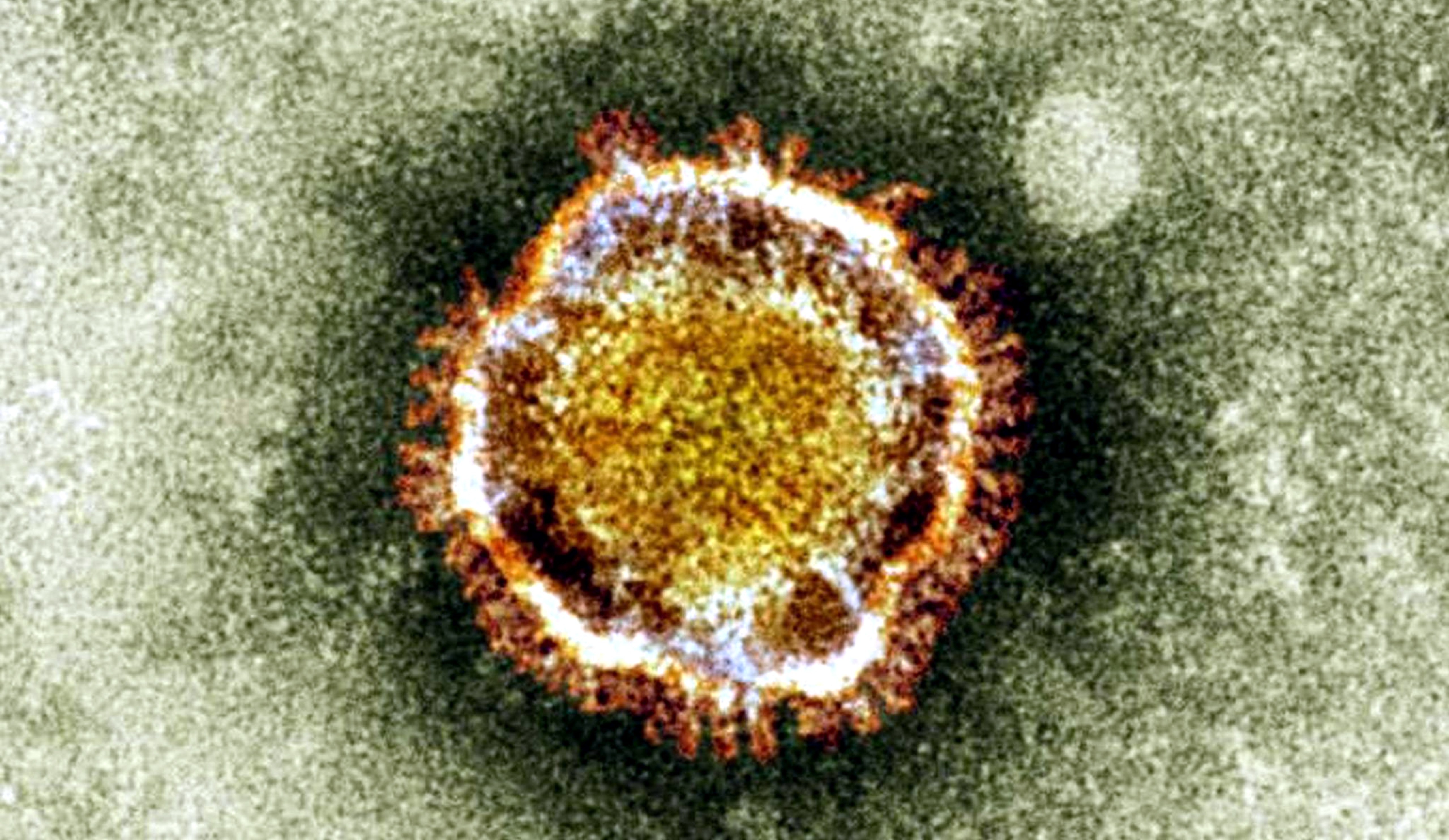 ¿Qué es el virus MERS? eju.tv