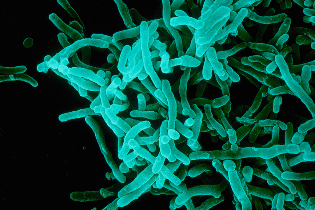 difteria