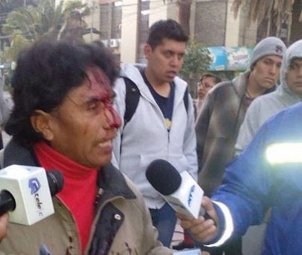 UNA DE LAS PERSONAS HERIDAS