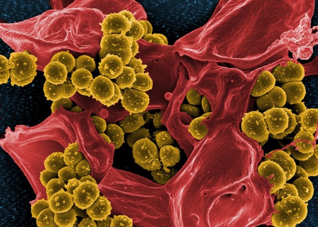 Bacteria 808158 1280