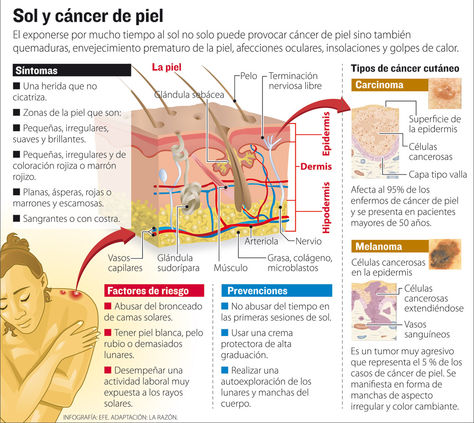Info cáncer de piel.