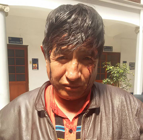 Diputado-opositor-denuncia-agresion-de-mallkus-afines-al-MAS