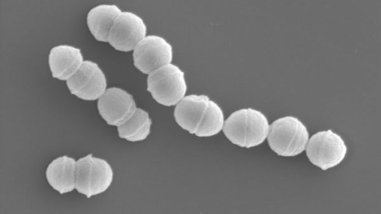 Alerta por el aumento de casos de enfermedad ‘carnívora' en Japón