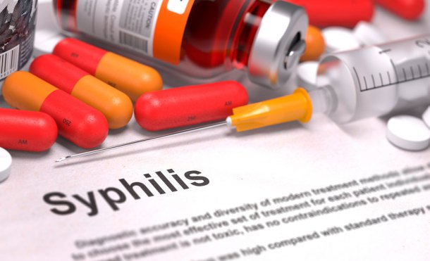 sífilis