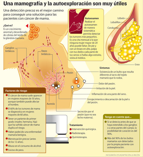 Infografía: Mamografía y autoexploración son muy útiles. Fuente: EFE