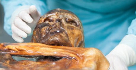 Photo published for Bacteria found in Iceman Otzi's gut reveal human migration story