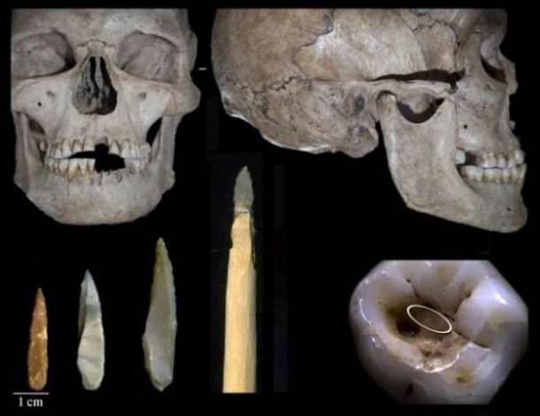 Dentistas Prehistóricos