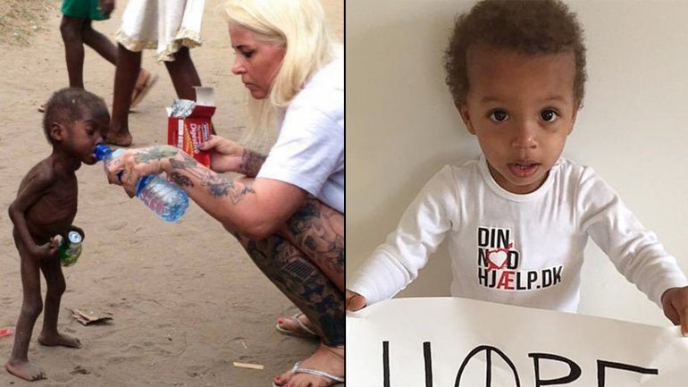 El antes y el después: la triste imagen que dio vuelta al mundo y la salud del niño en la actualidad