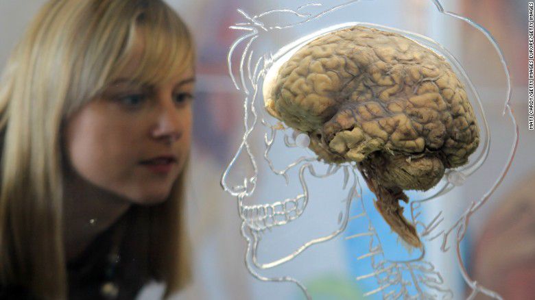 real-human-brain-getty-exlarge-169
